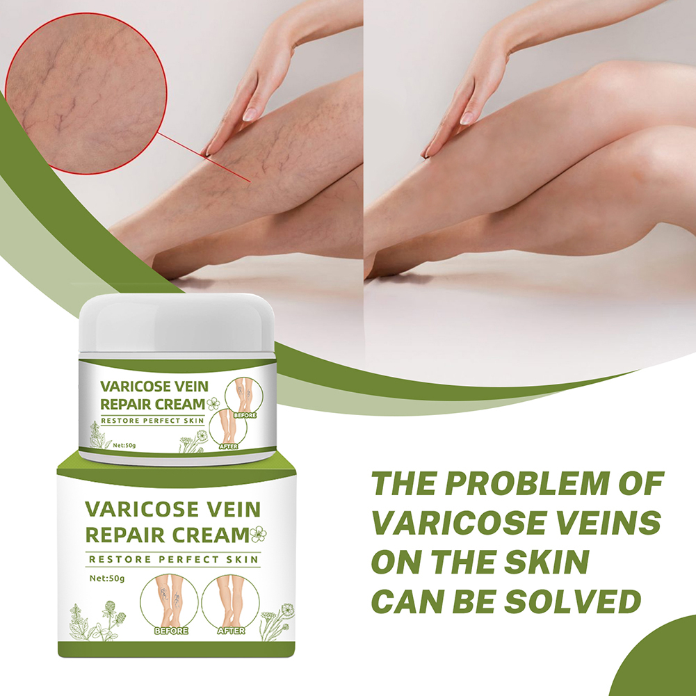 Varicose Vein Repair Cream(50GM)