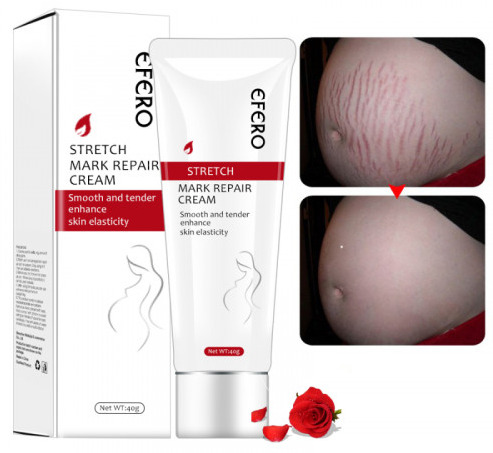 EFERO  Pregnancy Stretch Mark Repair Cream (40 GM)