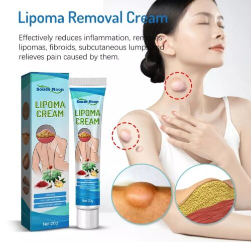 South Moon™ Lipoma Treatment Ointment (20 gm)